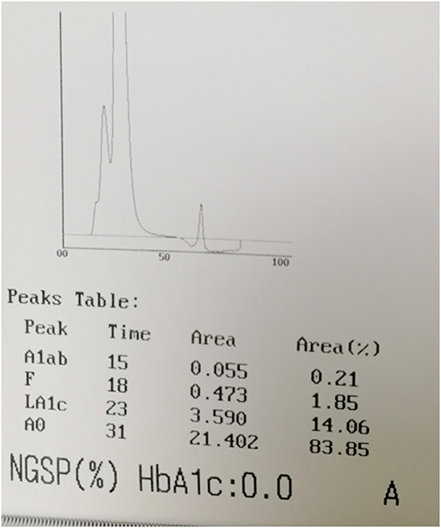 案例分析-糖化血红蛋白为0-3.jpg